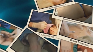 فیلر گانا ایکس رومئومد