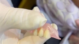 فیلم گذاشتن دندان ژله ای کلنیک مستر دندان