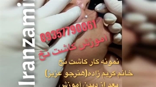 آموزش لیفت نخ مجازی آنلاین حضوری