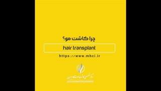 کاشت مو به روش DHI