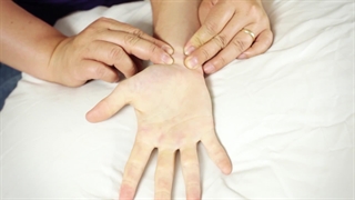 تست آلن برای سندروم تونل گویان