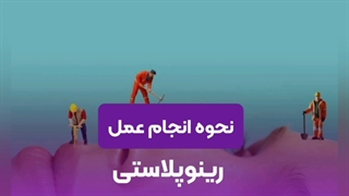 نحوه عمل رینوپلاستی