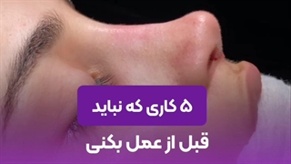 مراقبت های قبل از عمل رینوپلاستی