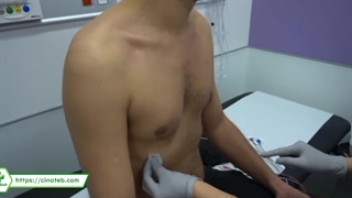 هولتر ریتم قلب | سینا طب